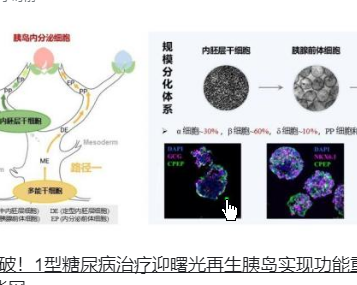 <strong>重要突破!1型糖尿病治疗迎曙光</strong>